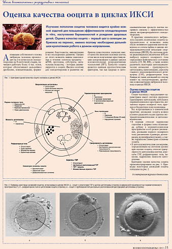 Оценка качества ооцита в циклах ИКСИ