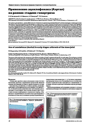 Применение ацеклофенака (Аэртал)  на ранних стадиях гонартроза