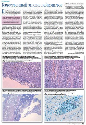 Качественный анализ лейкоцитов