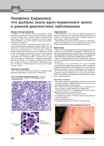 Лимфома Ходжкина: что должен знать врач первичного звена  о ранней диагностике заболевания