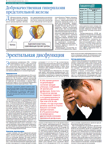 Доброкачественная гиперплазия предстательной железы