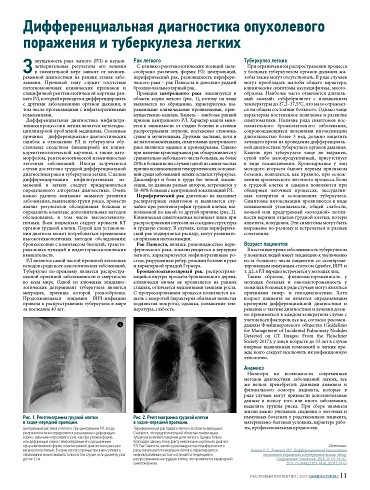 Дифференциальная диагностика опухолевого поражения и туберкулеза легких