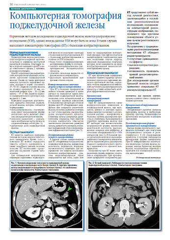 Компьютерная томография поджелудочной железы