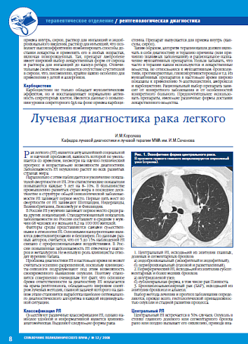Лучевая диагностика рака легкого