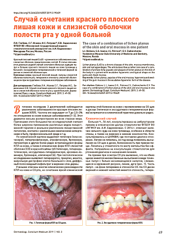 Случай сочетания красного плоского лишая кожи и слизистой оболочки полости рта у одной больной