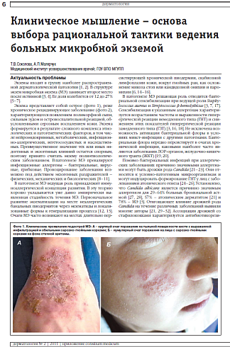 Клиническое мышление – основа выбора рациональной тактики ведения больных микробной экземой