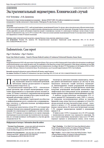 Экстрагенитальный эндометриоз. Клинический случай