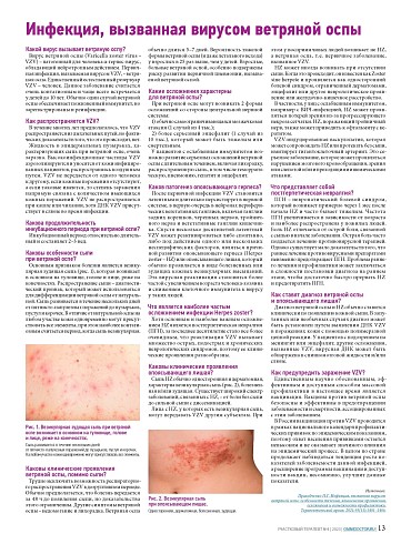 Инфекция, вызванная вирусом ветряной оспы