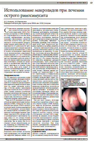 Использование макролидовпри леченииострого риносинусита 