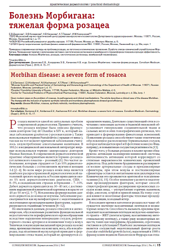 Болезнь Морбигана:  тяжелая форма розацеа