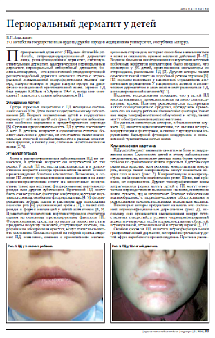 Периоральный дерматит у детей