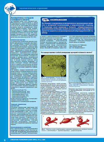 Аневризмы сосудов головного мозга