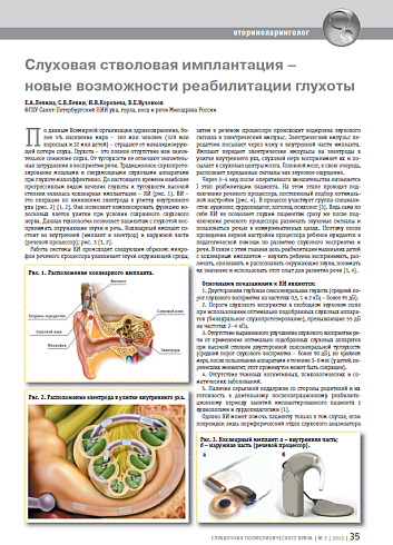 Слуховая стволовая имплантация – новые возможности реабилитации глухоты