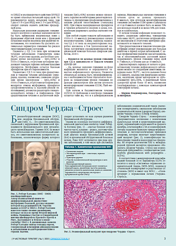 Синдром Черджа–Стросс