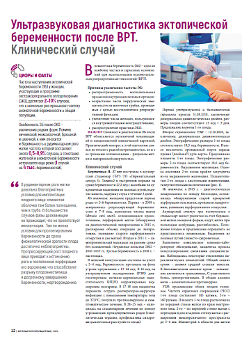 Ультразвуковая диагностика эктопической беременности после ВРТ. Клинический случай