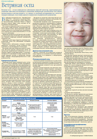 Ветряная оспа