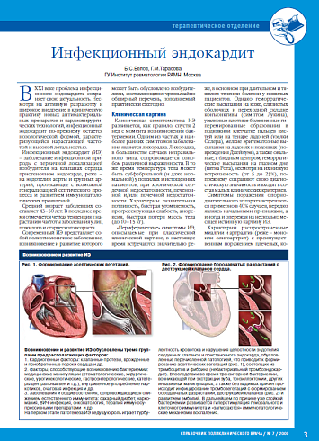 Инфекционный эндокардит
