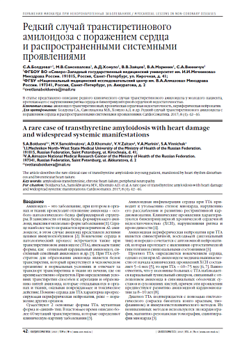 Редкий случай транстиретинового амилоидоза с поражением сердца  и распространенными системными проявлениями