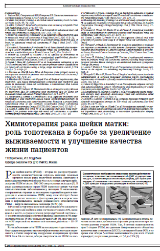 Химиотерапия рака шейки матки:  роль топотекана в борьбе за увеличение выживаемости и улучшение качества жизни пациентов