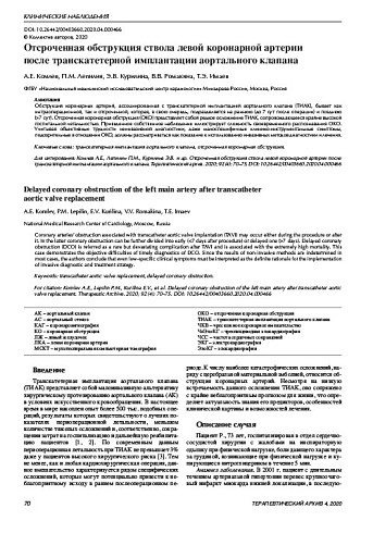 Отсроченная обструкция ствола левой коронарной артерии  после транскатетерной имплантации аортального клапана