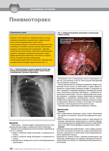 Пневмоторакс