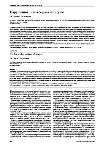 Нарушения ритма сердца и инсульт