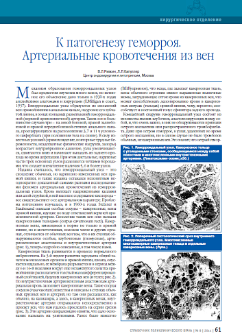 К патогенезу геморроя. Артериальные кровотечения из вен