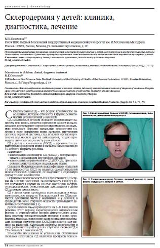 Склеродермия у детей: клиника, диагностика, лечение