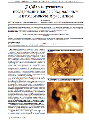 3D/4D-ультразвуковое  исследование плода с нормальным  и патологическим развитием