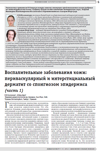 Воспалительные заболевания кожи: периваскулярный и интерстициальный дерматит со спонгиозом эпидермиса (часть 1)