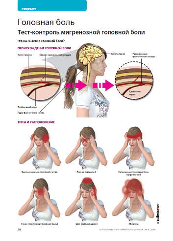 Тест головы. Тест на головную боль. Боль это тест ответы. Тест на Тип головной боли. Схема снятия мигренозного статуса.