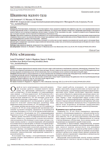 Шваннома малого таза