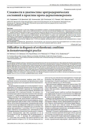 Сложности в диагностике эритродермических состояний в практике врача-дерматовенеролога