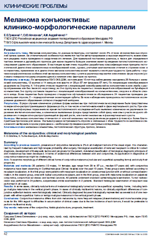 Меланома конъюнктивы:  клинико-морфологические параллели