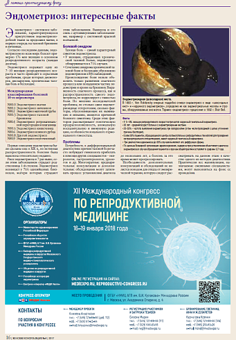 Эндометриоз: интересные факты