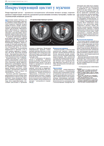 Инкрустирующий цистит у мужчин