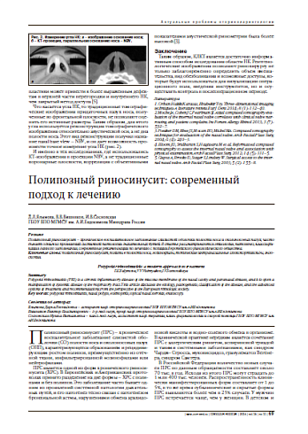 Полипозный риносинусит: современный подход к лечению