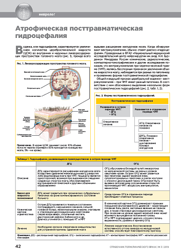 Атрофическая посттравматическая гидроцефалия