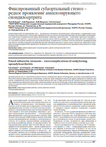 Фиксированный субаортальный стеноз – редкое проявление анкилозирующего спондилоартрита