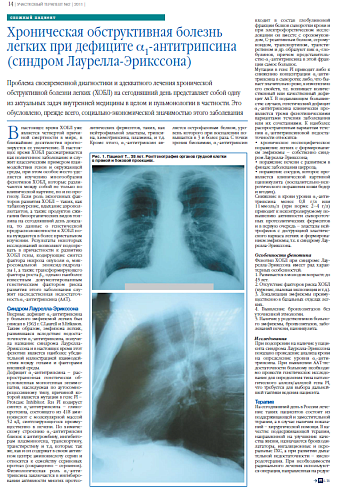 Хроническая обструктивная болезнь легких при дефиците a1-антитрипсина (синдром Лаурелла-Эрикссона)