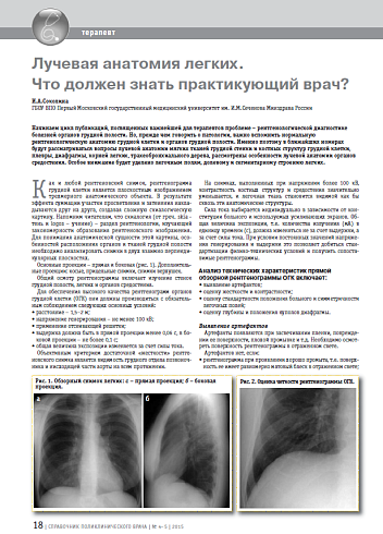 Лучевая анатомия легких. Что должен знать практикующий врач?