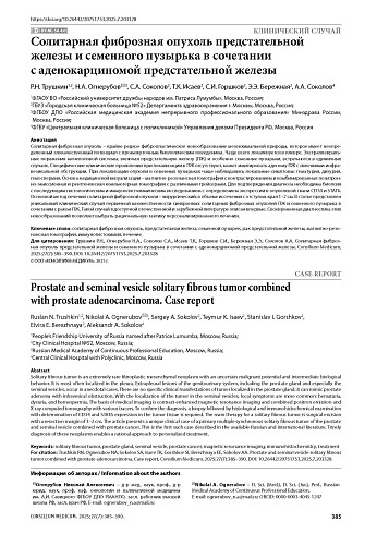 Солитарная фиброзная опухоль предстательной железы и семенного пузырька в сочетании с аденокарциномой предстательной железы