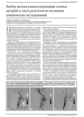 Выбор метода реваскуляризации сонных  артерий в свете результатов последних  клинических исследований