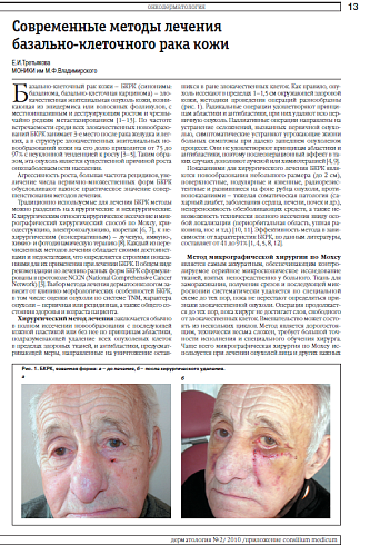 Современные методы лечения базально-клеточного рака кожи