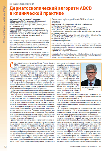 Дерматоскопический алгоритм ABCD  в клинической практике