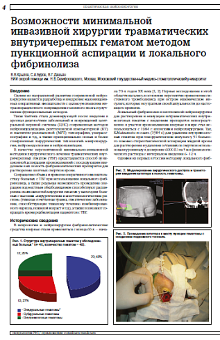 Возможности минимальной инвазивной хирургии травматических внутричерепных гематом методом пункционной аспирации и локального фибринолиза