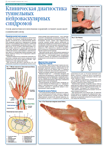 Клиническая диагностика туннельных нейроваскулярных синдромов 