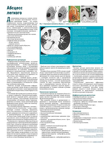 Абсцесс легкого