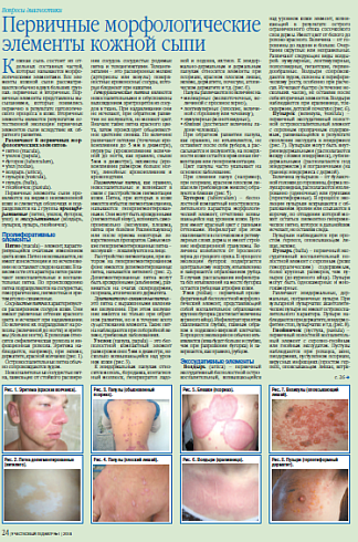 Первичные морфологические элементы кожной сыпи