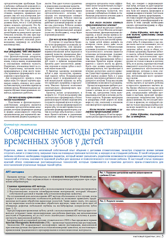 Современные методы реставрации временных зубов у детей